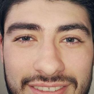 Haber Bandı Fotoğrafları